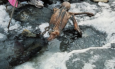 The prehistoric Similaun man treated with acupuncture